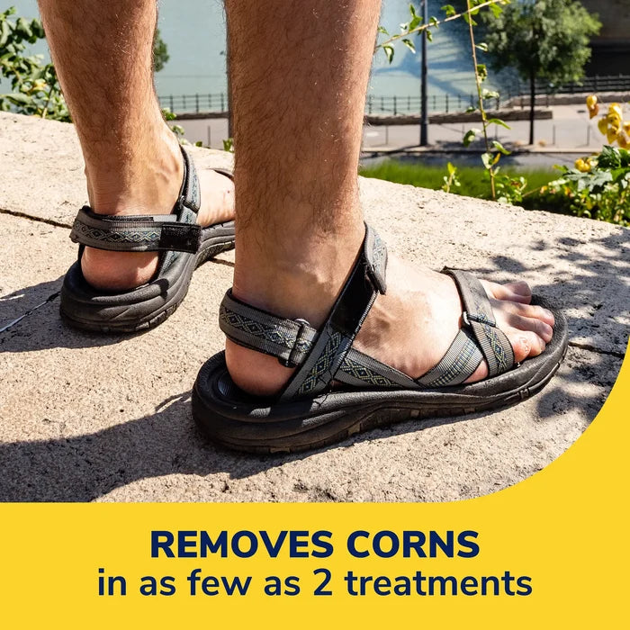 Feet wearing black patterned sandals, corn removers application promotional graphic below