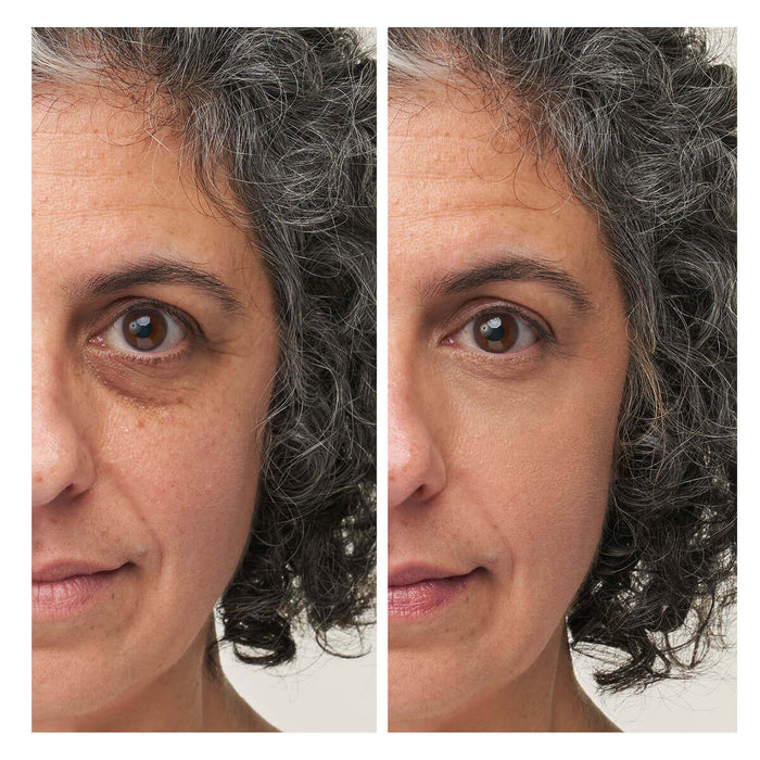 Enlighten Plus™ Under-eye Concealer