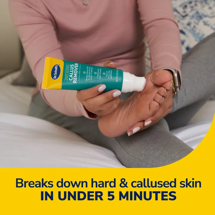 Callus remover gel tube being applied to a foot by hands