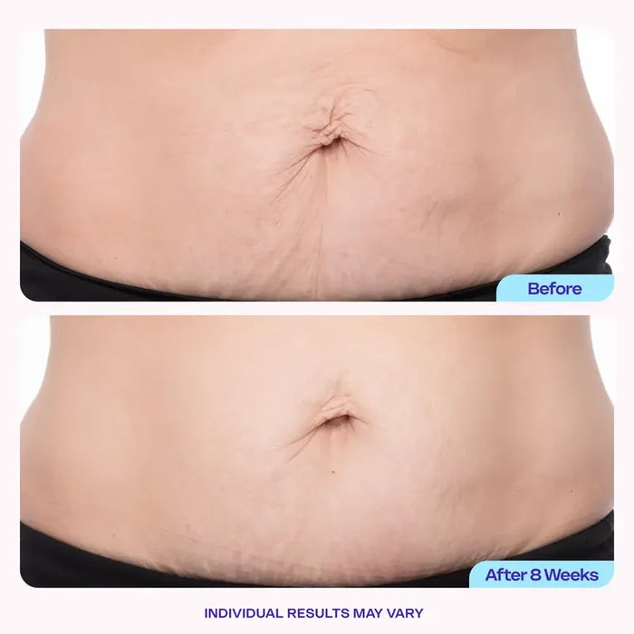 GOPURE Tighten & Smooth Belly Firming Cream