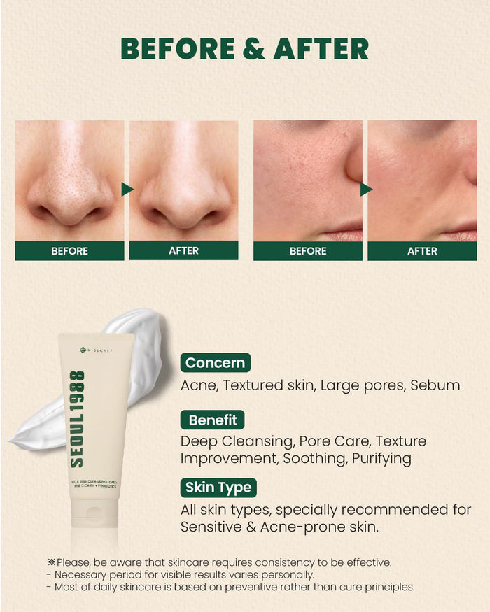 K-SECRET SEOUL 1988 Cleansing Foam - Pine Cica 1% + Probiotics 150 mL