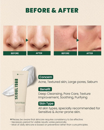K-SECRET SEOUL 1988 Cleansing Foam - Pine Cica 1% + Probiotics 150 mL