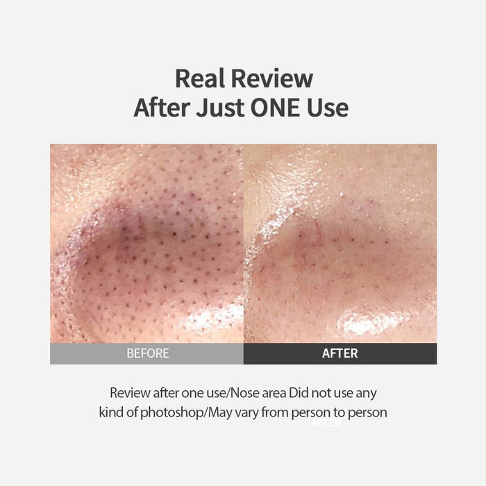 Sungboon Editor Blackhead Melting Clear Pad 30 pads