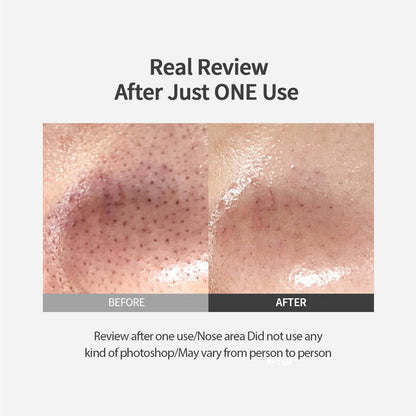 Sungboon Editor Blackhead Melting Clear Pad 30 pads