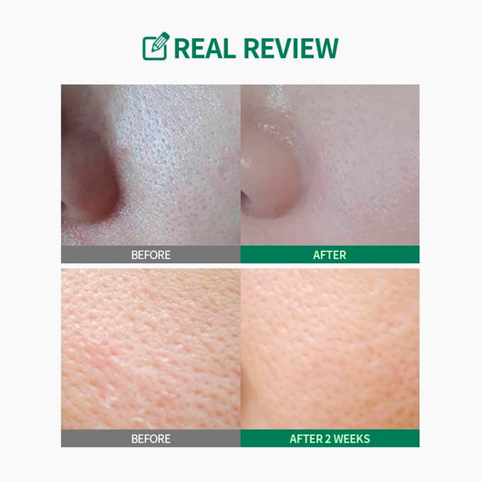 Sungboon Editor Green Tomato Pore Lifting Toner 11.83oz/ 350ml