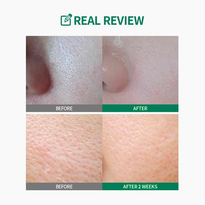 Sungboon Editor Green Tomato Pore Lifting Toner 11.83oz/ 350ml