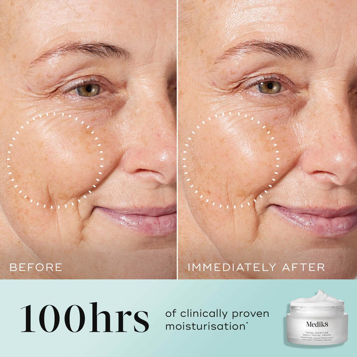 A split-screen before-and-after comparison of a woman's cheek and eye area, with a dotted circle highlighting visibly plumped skin and reduced wrinkles in the "IMMEDIATELY AFTER" photo. Text states "100 hours of clinically proven moisturisation*" alongside an image of the Medik8 Total Moisture jar.